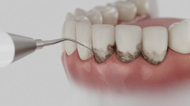 Trusted Root Canal Treatment service in Anthem, AZ - Dentist Open Now